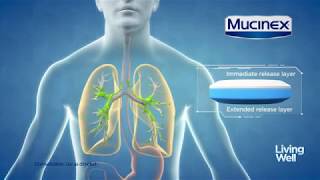 Treating Excess Mucus With Mucinex® Living Well [upl. by Lindberg965]