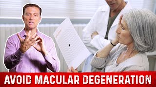 How to Prevent Macular Degeneration – Dr Berg [upl. by Veda982]