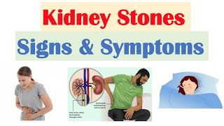 Kidney Stones Nephrolithiasis Signs amp Symptoms  amp Why They Occur [upl. by Ettelorahc]