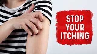 What Causes Hives and Itchiness  Urticaria Hives Treatment  Dr Berg [upl. by Adelice310]