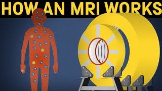 How does an MRI machine work [upl. by Noraj]