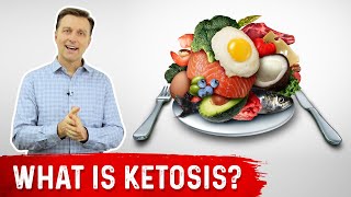 What is Ketosis  Dr Berg [upl. by Arerrac]